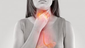 135 135603 acidity symptoms ways get rid 700x400