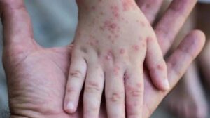 Images 2022 07 23T081428.766